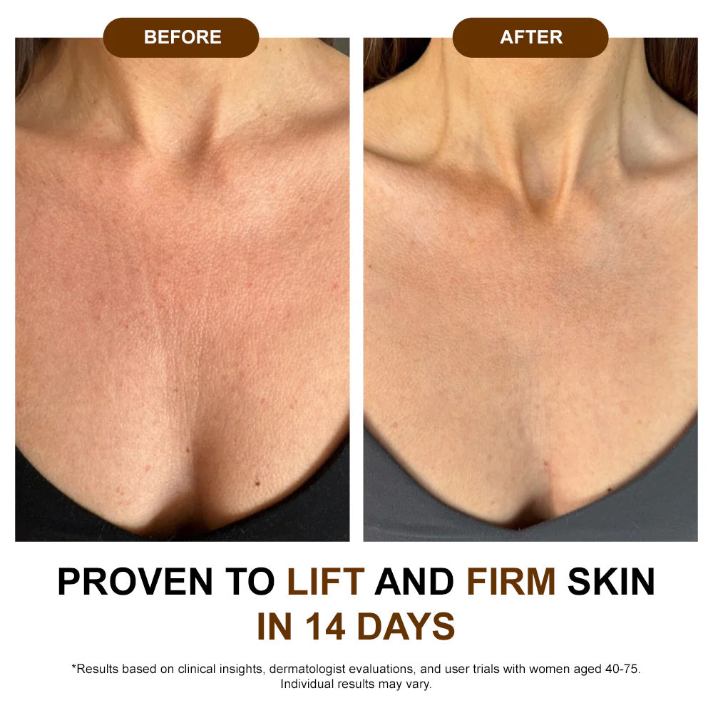 🔥𝐙𝐯𝐨𝐞𝐯𝐨® 𝐒𝐢𝐥𝐤 𝐁𝐨𝐝𝐲 𝐎𝐢𝐥 ✅ 𝐇𝐞𝐚𝐥𝐭𝐡 𝐂𝐚𝐧𝐚𝐝𝐚 𝐂𝐞𝐫𝐭𝐢𝐟𝐢𝐞𝐝 – Firms, Lifts & Smooths the Skin, Reduces Wrinkles, and Restores Youthful Elasticity